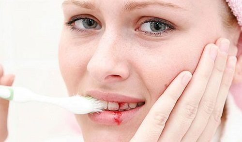 Đánh răng thế nào để chữa trị hôi miệng